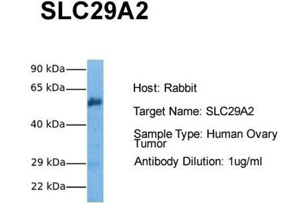 SLC29A2 antibody  (C-Term)