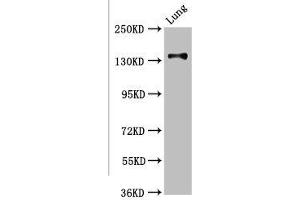 Western Blot Positive WB detected in: Rat kidney tissue All lanes: MAN2B2 antibody at 3. (MAN2B2 antibody  (AA 347-523))