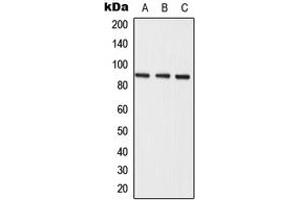 Western blot analysis of Semaphorin 3E expression in A549 (A), mouse liver (B), rat liver (C) whole cell lysates. (SEMA3E antibody  (Center))