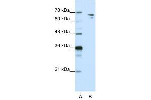 WB Suggested Anti-SF1 Antibody Titration:  1. (Splicing Factor 1 antibody  (N-Term))
