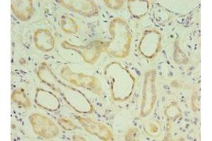 Immunohistochemistry of paraffin-embedded human kidney tissue using ABIN7159049 at dilution of 1:100 (Matrilin 3 antibody  (AA 277-486))