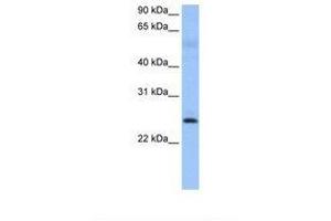 Image no. 1 for anti-Rhophilin Associated Tail Protein 1 (ROPN1) (AA 39-88) antibody (ABIN6738784) (ROPN1 antibody  (AA 39-88))