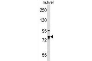 Western Blotting (WB) image for anti-La Ribonucleoprotein Domain Family, Member 4 (LARP4) antibody (ABIN2999557) (LARP4 antibody)