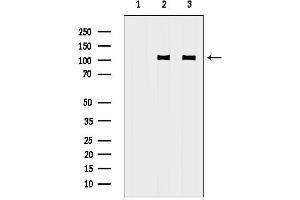 anti-Glutamate Receptor, Ionotropic, AMPA 3 (GRIA3) antibody