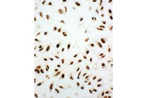 anti-X-Ray Repair Complementing Defective Repair in Chinese Hamster Cells 5 (Double-Strand-Break Rejoining) (XRCC5) (AA 648-662), (C-Term) antibody