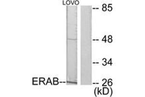 Western blot analysis of extracts from LOVO cells, using ERAB Antibody. (HSD17B10 antibody  (AA 111-160))