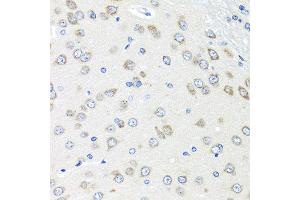 Immunohistochemistry of paraffin-embedded rat brain using PIAS3 antibody at dilution of 1:100 (40x lens). (PIAS3 antibody)