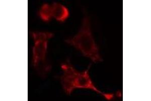 ABIN6275414 staining Hela cells by IF/ICC. (PPM1L antibody  (Internal Region))