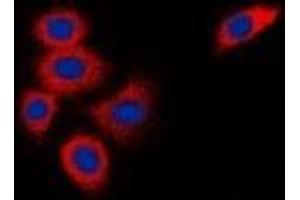 Immunofluorescent analysis of DOK1 staining in K562 cells. (DOK1 antibody)
