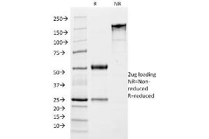 SDS-PAGE Analysis Purified Growth Hormone Monoclonal Antibody (SPM106). (Growth Hormone 1 antibody  (AA 58-187))