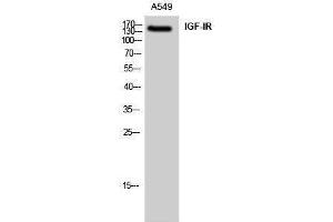 Western Blotting (WB) image for anti-Insulin-Like Growth Factor 1 Receptor (IGF1R) (Ser528) antibody (ABIN3175602) (IGF1R antibody  (Ser528))
