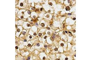 Immunohistochemistry (IHC) image for anti-BMI1 Polycomb Ring Finger Oncogene (BMI1) antibody (ABIN7307570)