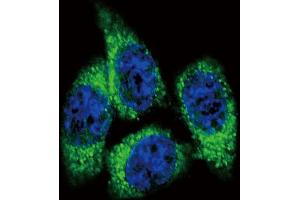 Confocal immunofluorescent analysis of CYP17A1 Antibody (Center) (ABIN392362 and ABIN2841999) with Hela cell followed by Alexa Fluor? (CYP17A1 antibody  (AA 358-388))