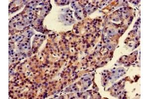 Immunohistochemistry of paraffin-embedded human pancreatic tissue using ABIN7170725 at dilution of 1:100 (STMN2 antibody  (AA 61-129))