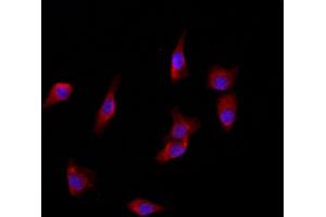 ABIN6266079 and ABIN6272868 staining HepG2 by IF/ICC. (YME1L1 antibody  (C-Term))