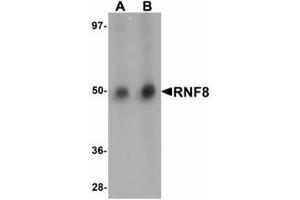 Image no. 1 for anti-Ring Finger Protein 8 (RNF8) (C-Term) antibody (ABIN478298) (RNF8 antibody  (C-Term))