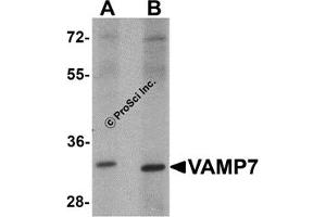 Western Blotting (WB) image for anti-Vesicle-Associated Membrane Protein 7 (VAMP7) antibody (ABIN1031804) (VAMP7 antibody)