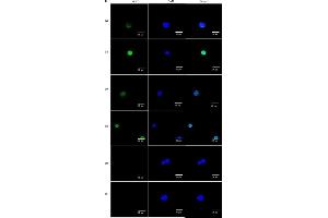 Extracellular signal-regulated kinase (ERK)1/2 is involved in MUC2 expression in NAD+-treated cells.