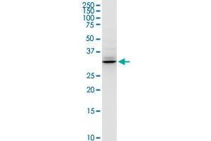 Western Blotting (WB) image for anti-Hydroxyacyl-CoA Dehydrogenase (HADH) (AA 1-314) antibody (ABIN516344)
