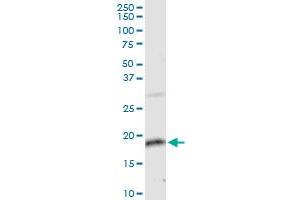 anti-Zinc Finger, Matrin-Type 4 (ZMAT4) (AA 1-153) antibody