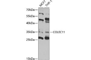 Western blot analysis of extracts of various cell lines, using COLEC11 antibody (ABIN6130117, ABIN6138854, ABIN6138855 and ABIN6220812) at 1:1000 dilution. (COLEC11 antibody  (AA 26-271))