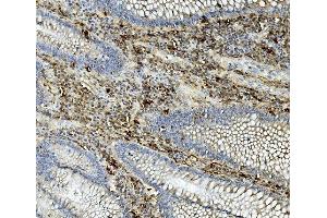 IHC analysis of ASAH1 using anti-ASAH1 antibody (ABIN7602206). (ASAH1 antibody  (AA 63-393))