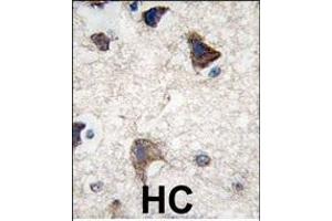 Immunohistochemistry (Paraffin-embedded Sections) (IHC (p)) image for anti-Cadherin 4 (CDH4) (AA 175-203), (N-Term) antibody (ABIN388148)