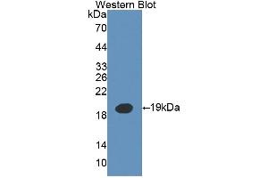 Detection of Recombinant IL3, Mouse using Polyclonal Antibody to Interleukin 3 (IL3)