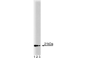 Western Blotting (WB) image for anti-Retinol Binding Protein 4, Plasma (RBP4) (AA 1-135) antibody (ABIN967847) (RBP4 antibody  (AA 1-135))
