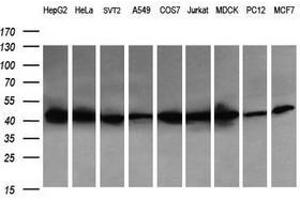Image no. 5 for anti-Acetyl-CoA Acyltransferase 2 (ACAA2) antibody (ABIN1495727) (ACAA2 antibody)