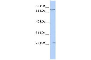 STRA6 antibody used at 1 ug/ml to detect target protein. (STRA6 antibody)