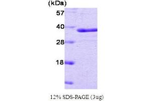 SDS-PAGE (SDS) image for Protein tyrosine Phosphatase, Non-Receptor Type 1 (PTPN1) protein (ABIN666832) (PTPN1 Protein)