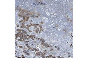 Immunohistochemical staining of human cerebellum with PCNT polyclonal antibody  shows strong cytoplasmmic positivity in Purkinje cells at 1:50-1:200 dilution.