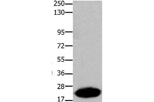 Western Blot analysis of Human liver cancer tissue using Claudin 7 Polyclonal Antibody at dilution of 1:1050 (Claudin 7 antibody)