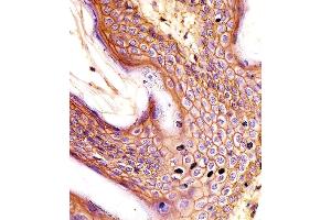 (ABIN659120 and ABIN2843760) staining CD44 in human skin tissue sections by Immunohistochemistry (IHC-P - paraformaldehyde-fixed, paraffin-embedded sections). (CD44 antibody)