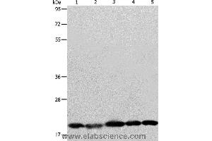 Western blot analysis of Human brain malignant glioma tissue, MCF7, Raji, Lovo and 293T cell, using BAX Polyclonal Antibody at dilution of 1:426 (BAX antibody)
