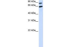 WB Suggested Anti-DVL2 Antibody Titration:  0. (DVL2 antibody  (N-Term))