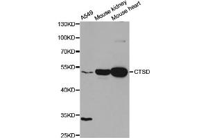 Western blot analysis of extracts of various cell lines, using CTSD antibody. (Cathepsin D antibody)