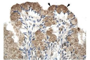 NCOR1 antibody was used for immunohistochemistry at a concentration of 4-8 ug/ml to stain Epithelial cells of intestinal villus (arrows) in Human Intestine. (NCOR1 antibody  (N-Term))