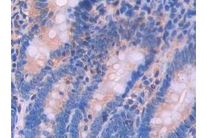 Used in DAB staining on fromalin fixed paraffin- embedded testis tissue (Renin antibody  (AA 144-237))
