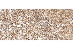 Immunohistochemistry of paraffin-embedded Human tonsil tissue using ZNF354A Polyclonal Antibody at dilution of 1:40(x200)