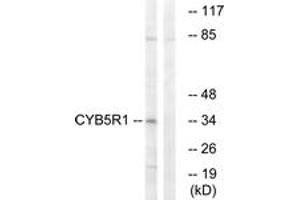 Western blot analysis of extracts from RAW264. (CYB5R1 antibody  (AA 9-58))