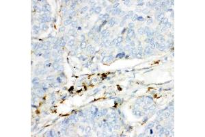 Immunohistochemistry (IHC) image for anti-Hexosaminidase B (Beta Polypeptide) (HEXB) (AA 381-556) antibody (ABIN3042442)