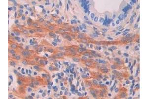 Detection of MYLK in Mouse Uterus Tissue using Polyclonal Antibody to Myosin Light Chain Kinase (MYLK) (MYLK antibody  (AA 1684-1884))
