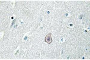 Image no. 2 for anti-Prostaglandin E Receptor 3 (Subtype EP3) (PTGER3) antibody (ABIN317859)