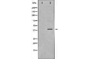 Western blot analysis of MKK3 phosphorylation expression in MDA-MB-435 whole cell lysates,The lane on the left is treated with the antigen-specific peptide. (MAP2K3 antibody  (pSer189))