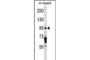 EXOC6B Antibody (C-term) (ABIN657578 and ABIN2846582) western blot analysis in mouse heart tissue lysates (35 μg/lane). (EXOC6B antibody  (C-Term))