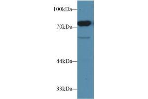 Western blot analysis of Rat Testis lysate, using Rat CD2AP Antibody (1 µg/ml) and HRP-conjugated Goat Anti-Rabbit antibody ( (CD2AP antibody  (AA 368-623))