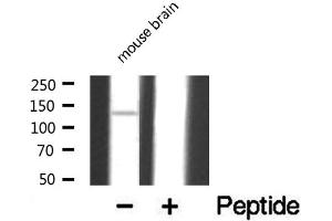 Western blot analysis of extracts from mouse brain , using DGKD antibody. (DGKD antibody  (N-Term))