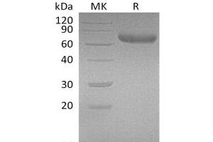 Western Blotting (WB) image for Prolactin Receptor (PRLR) protein (Fc Tag) (ABIN7320784) (Prolactin Receptor Protein (PRLR) (Fc Tag))